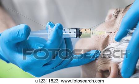Platelet-rich plasma facial treatment. Mature woman receiving platelet-rich plasma injections for reducing wrinkles. View Large Photo Image Stock Image - Platelet-rich plasma facial treatment. Mature woman receiving platelet-rich plasma injections for reducing wrinkles.. Fotosearch
