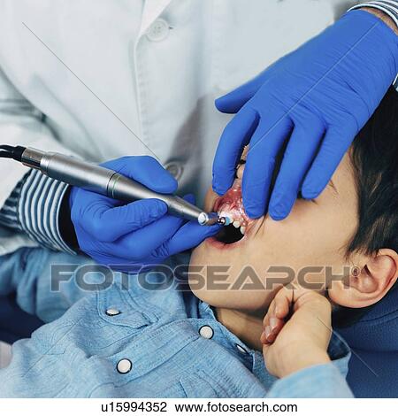 Removing dental calculus from boy's teeth View Large Photo Image Stock Image - Removing dental calculus from boy's teeth. Fotosearch