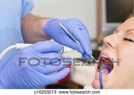 Removing dental tartar View Large Photo Image Stock Image - Removing dental tartar. Fotosearch