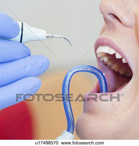 Removing dental tartar View Large Photo Image Stock Image - Removing dental tartar. Fotosearch