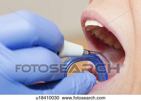 Removing dental tartar View Large Photo Image Stock Image - Removing dental tartar. Fotosearch