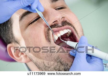 Stock Photo - Removing dental tartar. Fotosearch