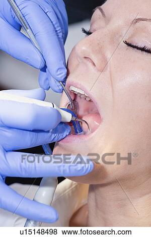 Removing dental tartar View Large Photo Image Stock Photo - Removing dental tartar. Fotosearch