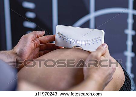 Stock Image - Scoliosis screening with scoliometer. Fotosearch