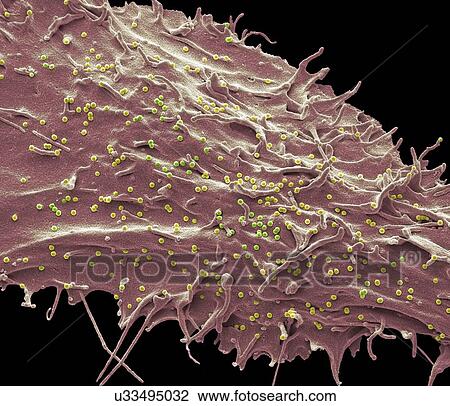 Stock Image - SIV infected cell, SEM. Fotosearch
