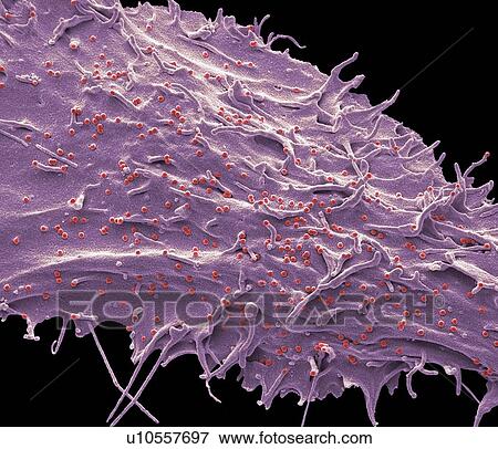 Stock Photo - SIV infected cell, SEM. Fotosearch