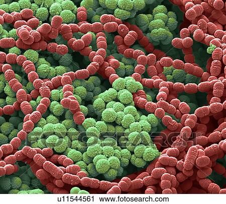 Sputum culture, SEM View Large Photo Image Stock Image - Sputum culture, SEM. Fotosearch