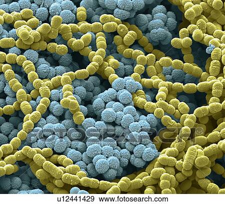 Stock Photo - Sputum culture, SEM. Fotosearch