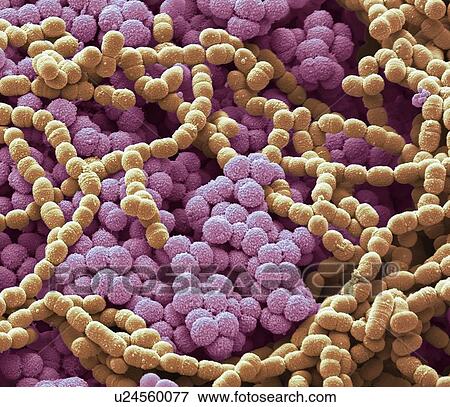 Sputum culture, SEM View Large Photo Image Stock Photo - Sputum culture, SEM. Fotosearch