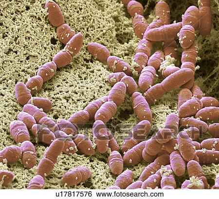 Streptococcus mutans, SEM View Large Photo Image Stock Photograph - Streptococcus mutans, SEM. Fotosearch