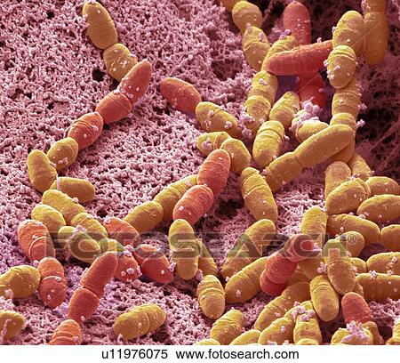 Streptococcus mutans, SEM View Large Photo Image Stock Photography - Streptococcus mutans, SEM. Fotosearch