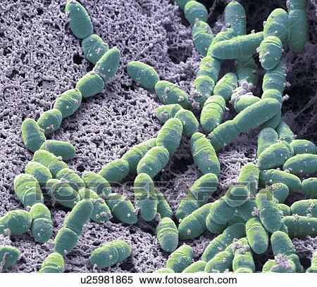 Streptococcus mutans, SEM View Large Photo Image Stock Photography - Streptococcus mutans, SEM. Fotosearch