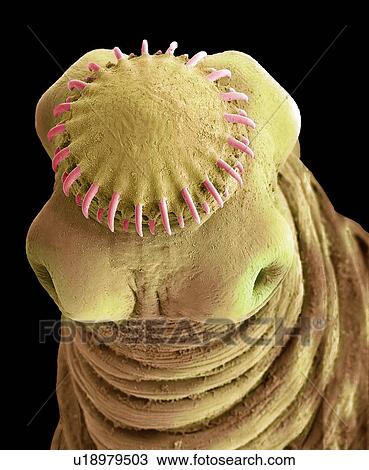 Stock Image - Tapeworm cysticercus, SEM. Fotosearch