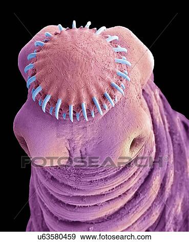 Stock Photo - Tapeworm cysticercus, SEM. Fotosearch