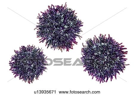 Stock Image - Thyroid cancer cells, illustration. Fotosearch