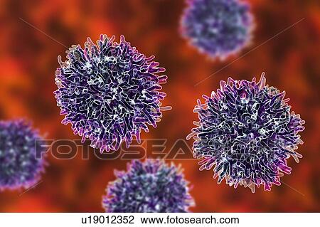 Stock Image - Thyroid cancer cells, illustration. Fotosearch