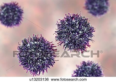 Stock Photograph - Thyroid cancer cells, illustration. Fotosearch