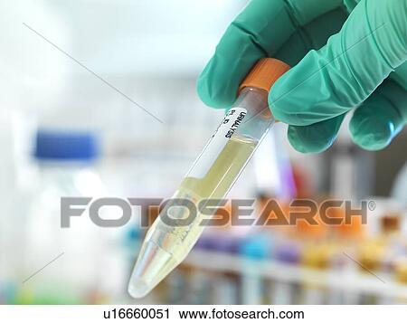 Stock Image - Urine test. Fotosearch