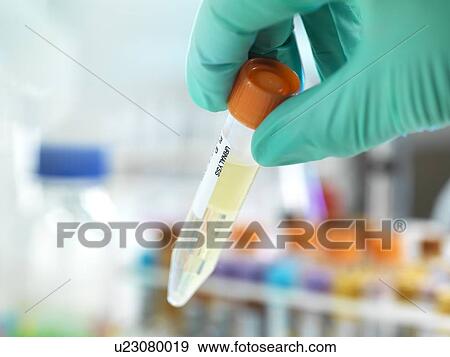 Stock Photo - Urine test. Fotosearch