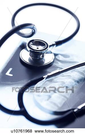 X-ray of neck with stethoscope. View Large Photo Image Stock Photo - X-ray of neck with stethoscope.. Fotosearch