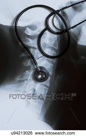 Stock Photograph - X-ray of neck with stethoscope.. Fotosearch