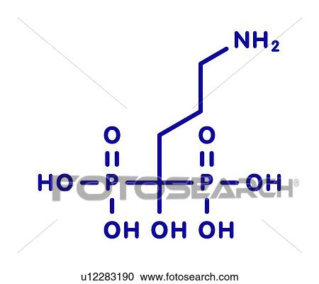 Stock Image - Alendronic acid osteoporosis drug, molecular model. Fotosearch