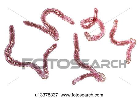 Stock Photo - Ancylostoma hookworm, illustration. Fotosearch
