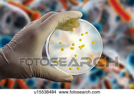 Picture - Bacterial and fungal cultures, composite image. Fotosearch