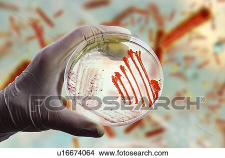 Picture - Bacterial and fungal cultures, composite image. Fotosearch