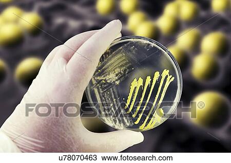 Bacterial and fungal cultures, composite image View Large Photo Image Stock Image - Bacterial and fungal cultures, composite image. Fotosearch