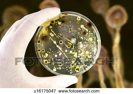 Bacterial and fungal cultures, composite image View Large Photo Image Stock Photo - Bacterial and fungal cultures, composite image. Fotosearch