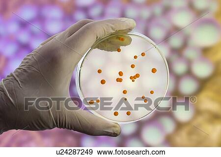 Stock Photo - Bacterial and fungal cultures, composite image. Fotosearch