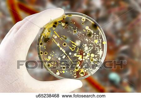 Stock Photo - Bacterial and fungal cultures, composite image. Fotosearch