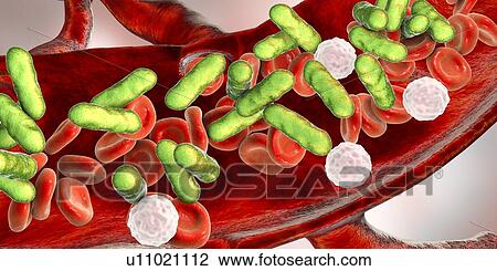 Stock Image - Bacterial blood infection, illustration. Fotosearch