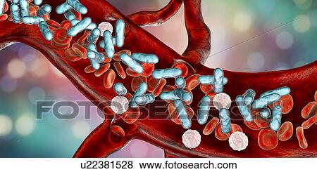 Bacterial blood infection, illustration View Large Photo Image Stock Photo - Bacterial blood infection, illustration. Fotosearch