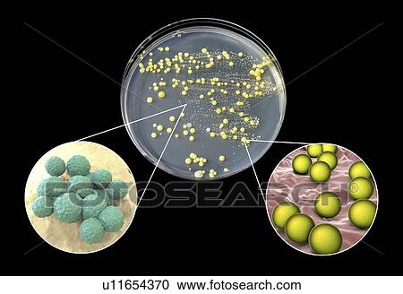 Bacterial culture grown from human skin, composite image View Large Photo Image Stock Image - Bacterial culture grown from human skin, composite image. Fotosearch