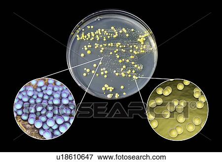 Stock Photo - Bacterial culture grown from human skin, composite image. Fotosearch