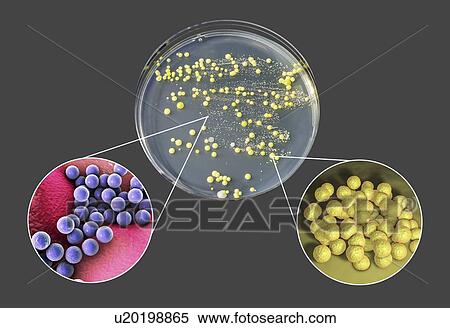 Stock Photography - Bacterial culture grown from human skin, composite image. Fotosearch
