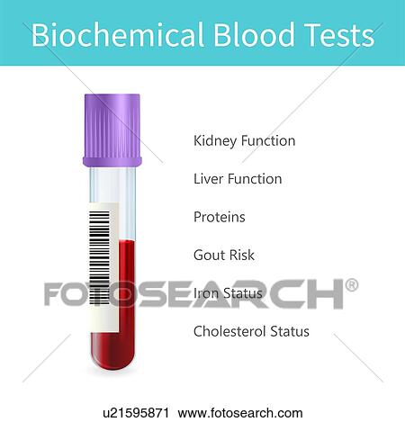 Stock Image - Biochemical blood tests, illustration. Fotosearch