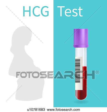 Blood pregnancy test, illustration View Large Photo Image Stock Image - Blood pregnancy test, illustration. Fotosearch