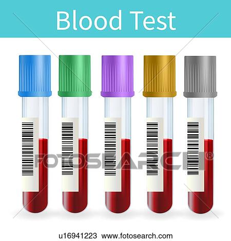 Stock Image - Blood sample tubes, illustration. Fotosearch