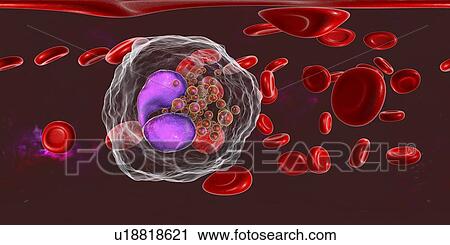 Blood smear with numerous eosinophils, illustration View Large Photo Image Stock Image - Blood smear with numerous eosinophils, illustration. Fotosearch