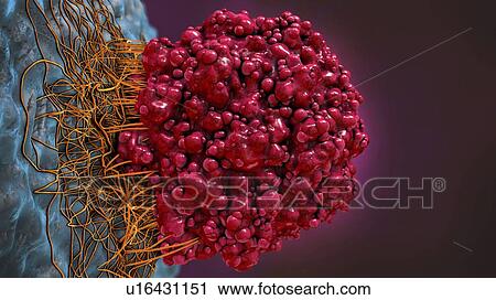 Stock Image - Cancer cell, illustration. Fotosearch