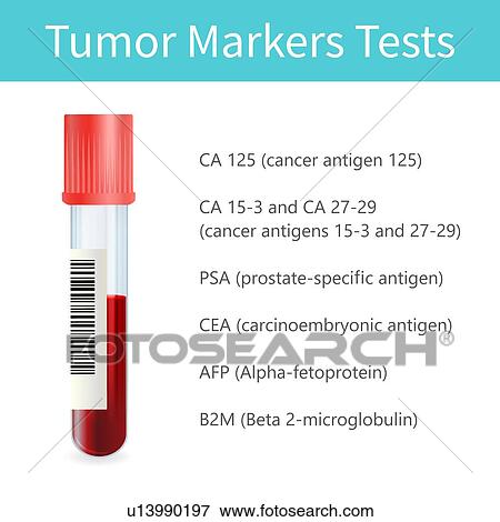 Cancer marker blood test, illustration View Large Photo Image Stock Photo - Cancer marker blood test, illustration. Fotosearch