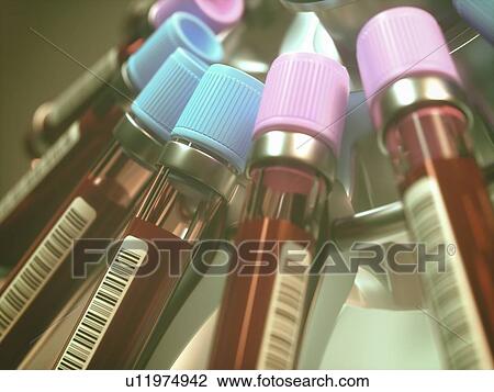 Centrifuging blood samples, computer illustration. View Large Photo Image Stock Image - Centrifuging blood samples, computer illustration.. Fotosearch