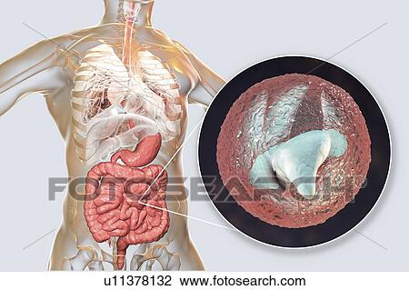 Cryptosporidium protozoan intestinal parasite, illustration View Large Photo Image Stock Image - Cryptosporidium protozoan intestinal parasite, illustration. Fotosearch