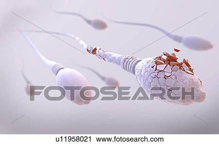 Stock Image - Damaged sperm, illustration. Fotosearch