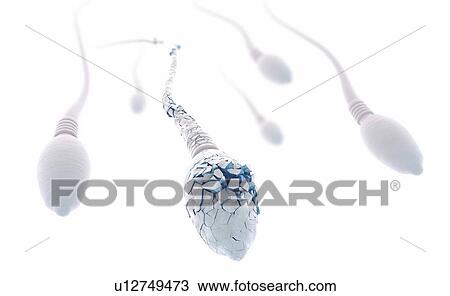 Stock Image - Damaged sperm, illustration. Fotosearch