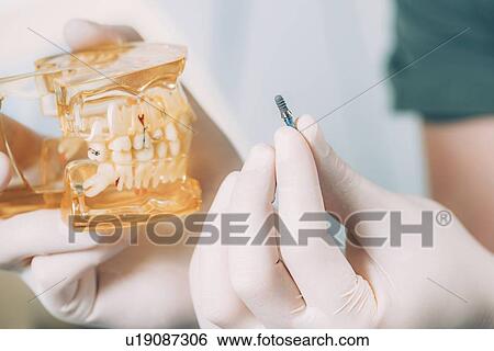 Dentist holding dental implant and model jaw View Large Photo Image Stock Photograph - Dentist holding dental implant and model jaw. Fotosearch