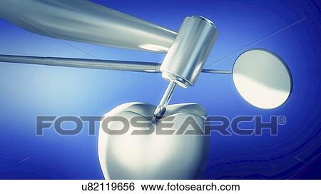 Stock Photograph - Dentistry, illustration. Fotosearch